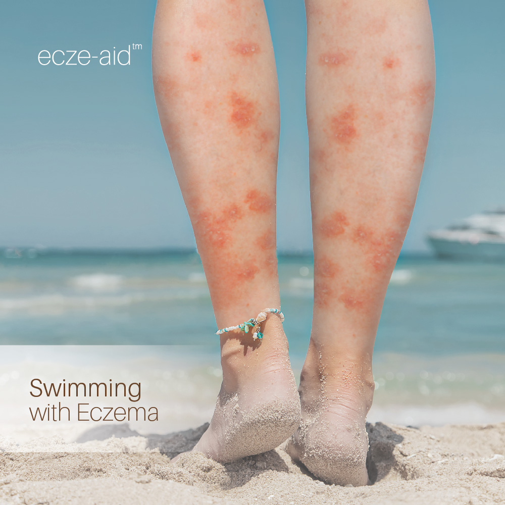 You are currently viewing Swimming With Eczema