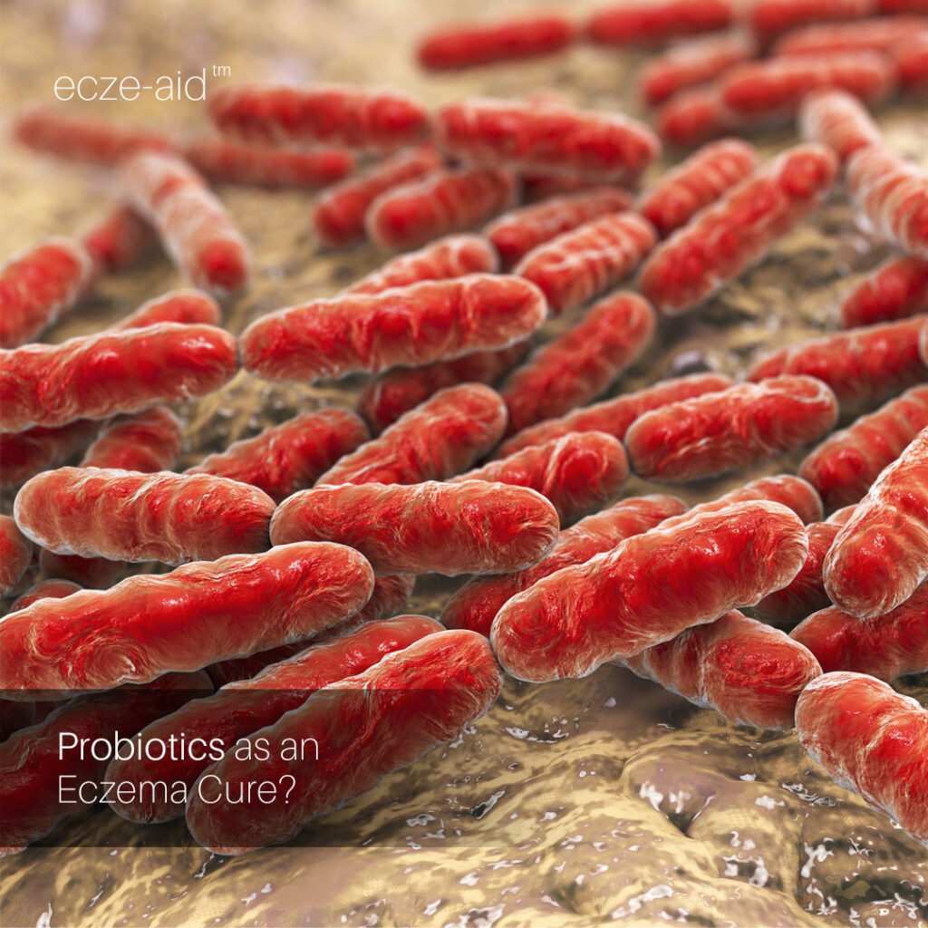 Can Probiotics Help Improve Eczema Treatment?